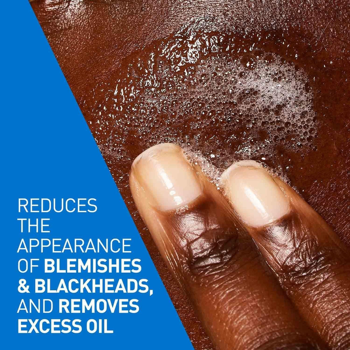 CERAVE BLEMISH CONTROL CLEANSER 236ML