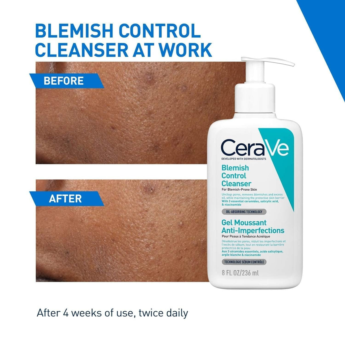CERAVE BLEMISH CONTROL CLEANSER 236ML