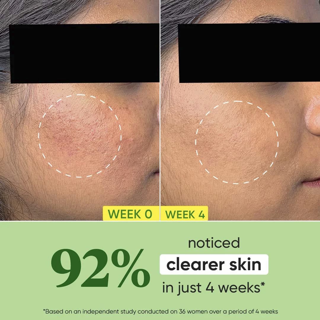 DOT & KEY CICA CALMING OIL FREE MOISTURIZER
