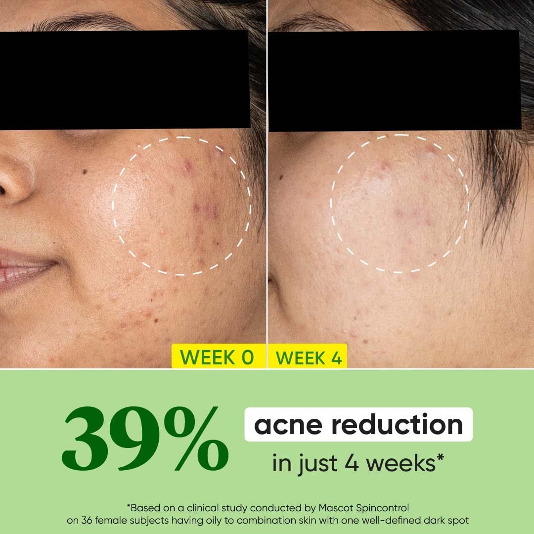 DOT & KEY CICA CALMING SKIN RENEWING NIGHT GEL WITH NIACINAMIDE & GREEN TEA
