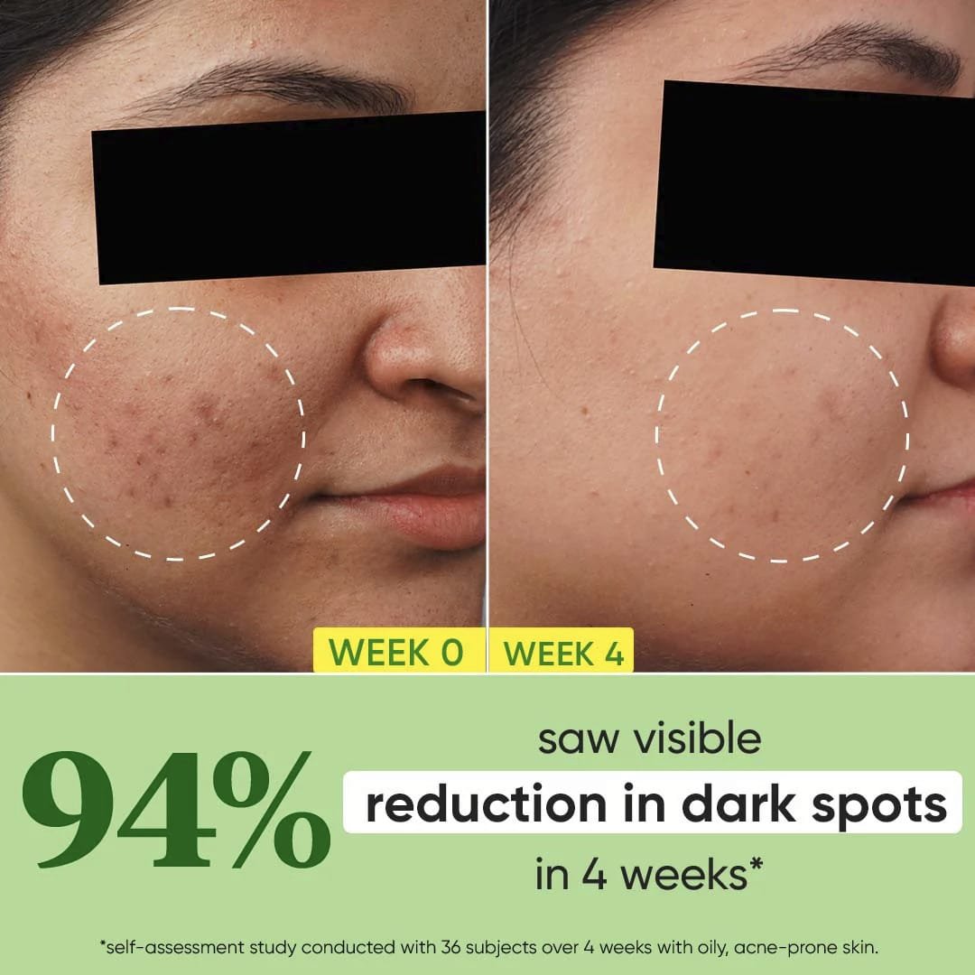 DOT & KEY CICA + 10PERC NIACINAMIDE SPOT REDUCTION FACE SERUM