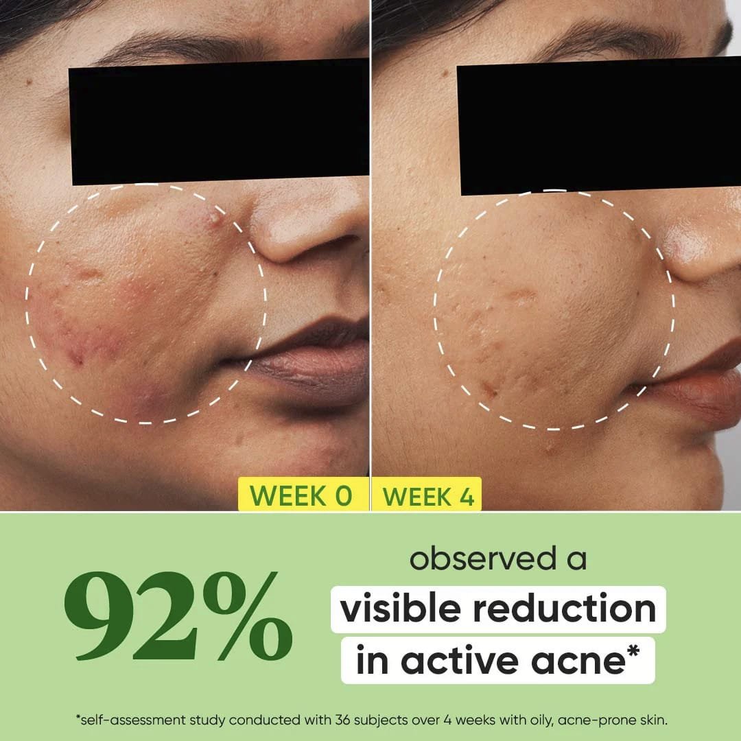 DOT & KEY CICA 2PERC SALICYLIC SKIN CLEARING FACE SERUM