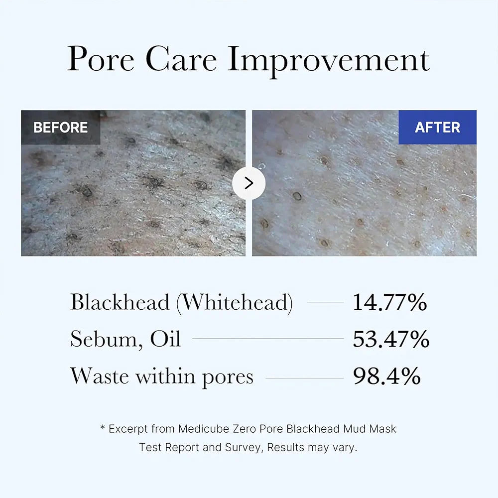 MEDICUBE zero pore blackhead mud mask 100g