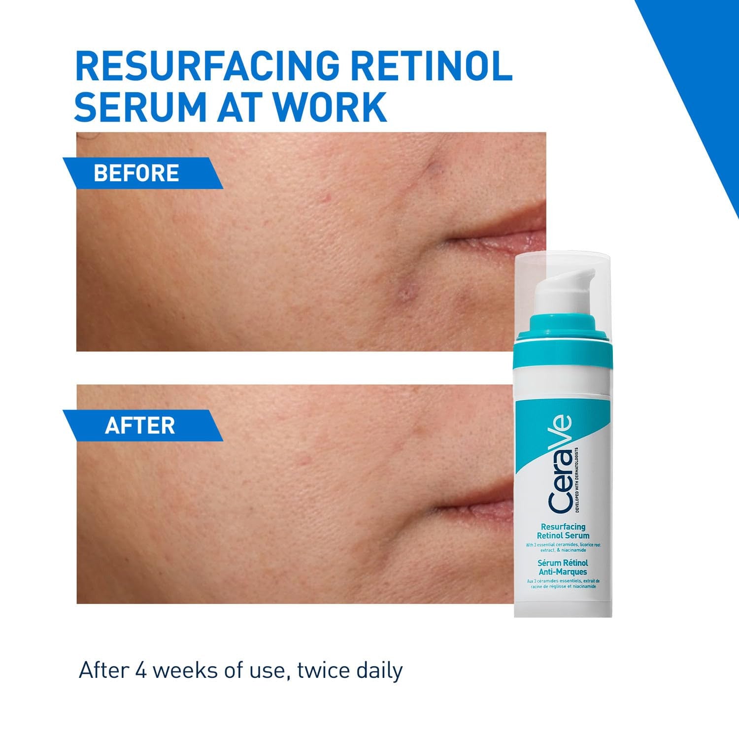 CERA VE RESURFACING RETINOL SERUM 30ML
