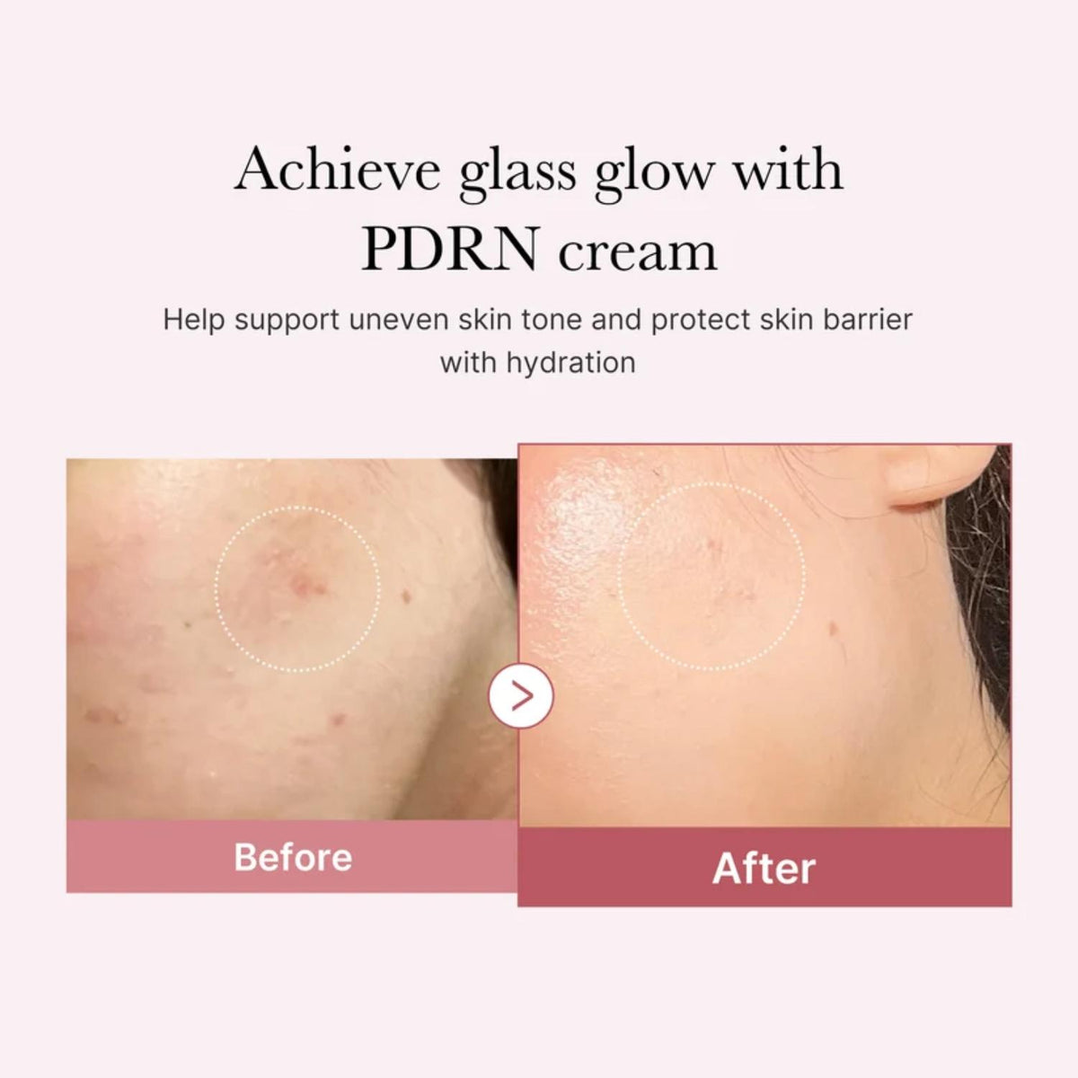 MEDICUBE PDRN PINK HYALURONIC MOISTURIZING CREAM 50ML