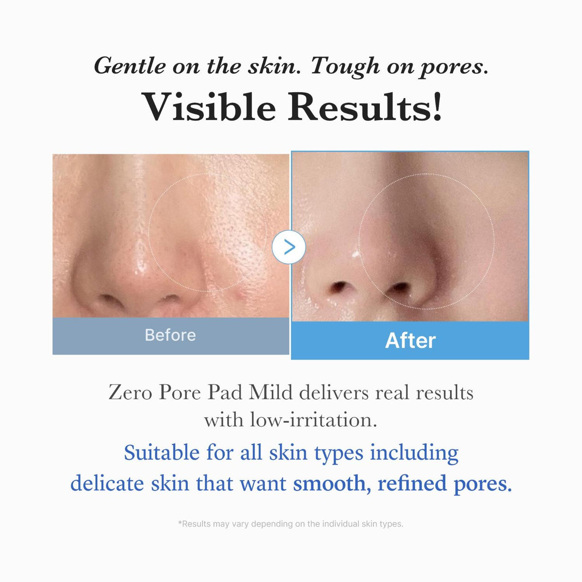 MEDICUBE ZERO PORE PAD MILD 155G-(70PADS)