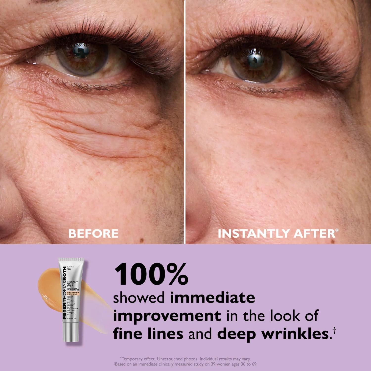PETER THOMAS ROTHINSTANT FIRMX EYE TEMPORARY EYE TIGHTENER 20ML