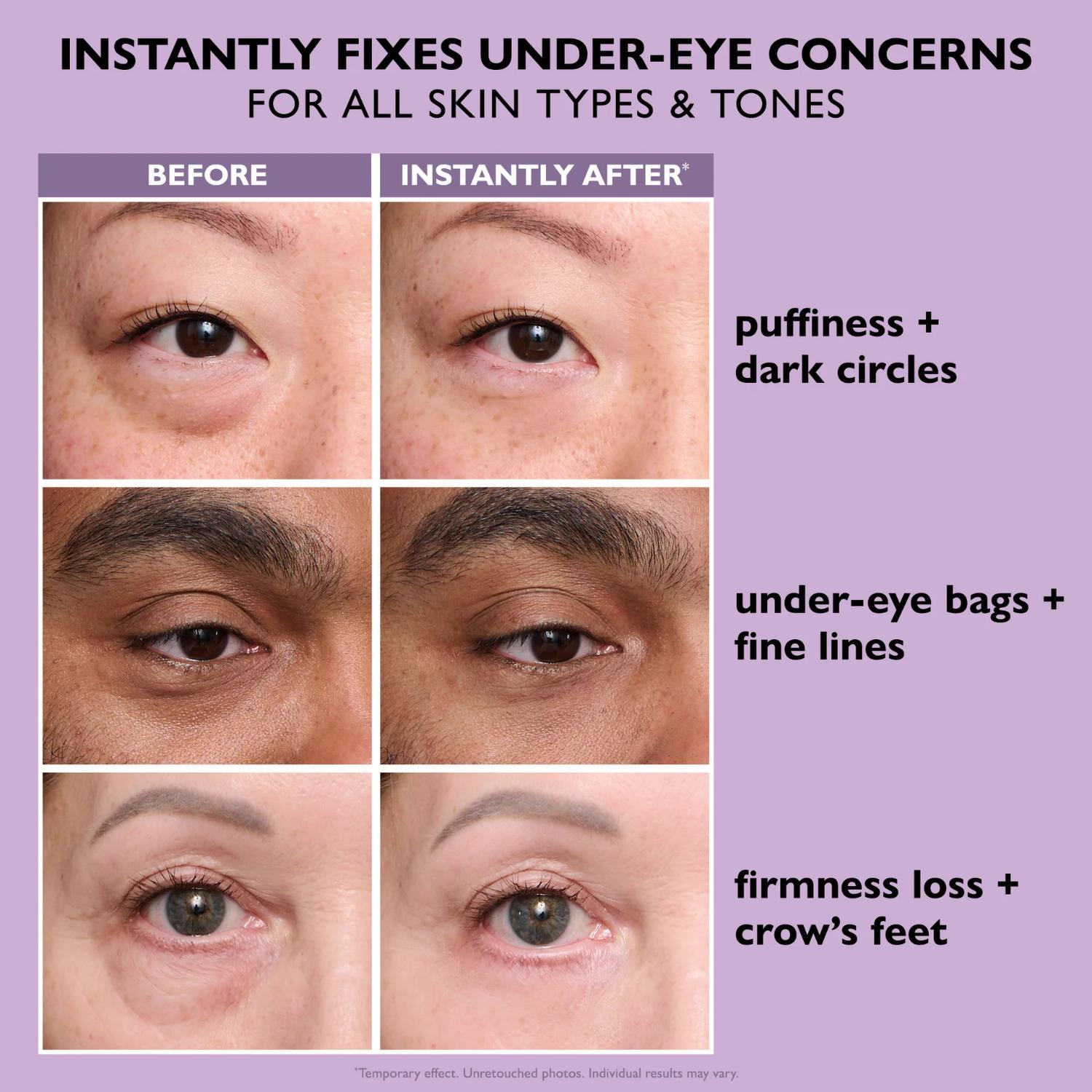 PETER THOMAS ROTHINSTANT FIRMX EYE TEMPORARY EYE TIGHTENER 20ML